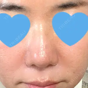 東京形成美容外科 銀座院の