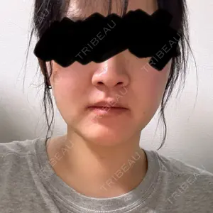 PRO CLINIC プロクリニック 銀座院口コミ