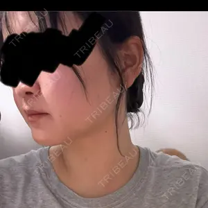 PRO CLINIC プロクリニック 銀座院口コミ