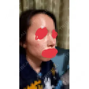 口コミ