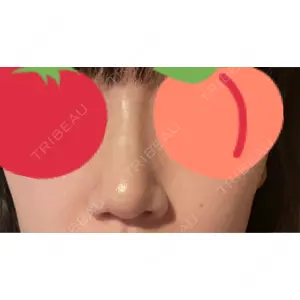 LUHO（ルホ）美容外科口コミ