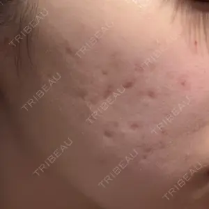 L‘amour clinic Tokyo【ラムールクリニック東京】口コミ