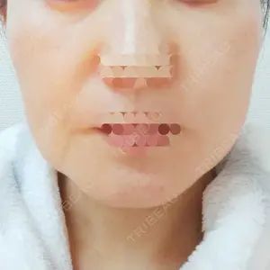 東京形成美容外科 東京形成美容外科 船橋院口コミ