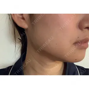 DMTC美容皮膚科 DMTC美容皮膚科 渋谷院口コミ