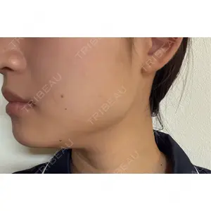 DMTC美容皮膚科 DMTC美容皮膚科 渋谷院口コミ