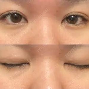 LUHO（ルホ）美容外科口コミ