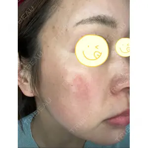 RAISE CLINIC 【レイズクリニック】口コミ