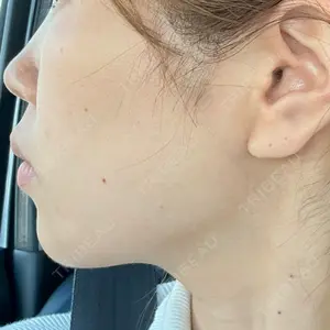 口コミ