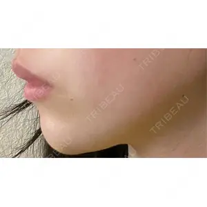 口コミ