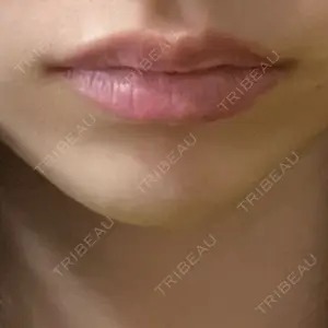 口コミ
