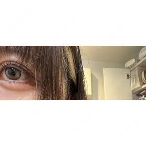 ハナビューティークリニック口コミ
