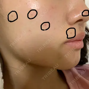 ニューセンス皮膚科クリニック口コミ