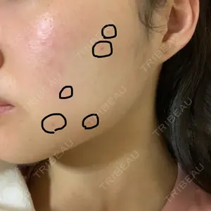 ニューセンス皮膚科クリニック口コミ