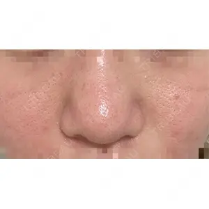 LUHO（ルホ）美容外科口コミ