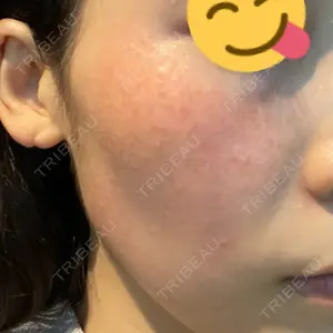 L‘amour clinic Tokyo【ラムールクリニック東京】口コミ