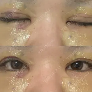 LUHO（ルホ）美容外科口コミ