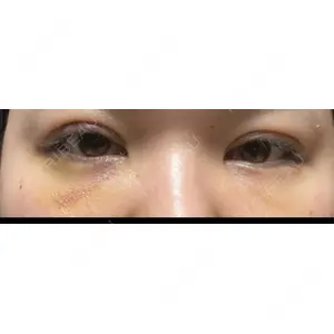 LUHO（ルホ）美容外科口コミ