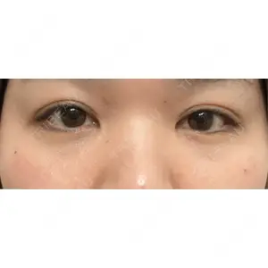 LUHO（ルホ）美容外科口コミ