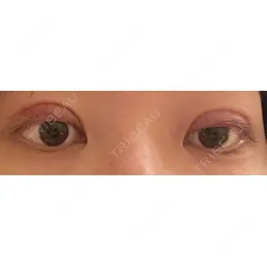 口コミ