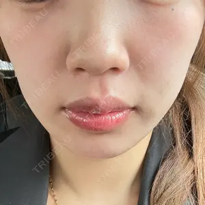 口コミ