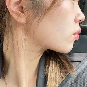 口コミ
