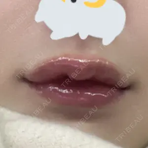 口コミ