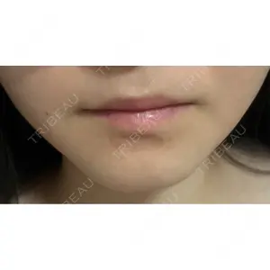 PRISM Beauty Clinic  PRISM Beauty Clinic 町田院口コミ