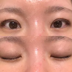 口コミ