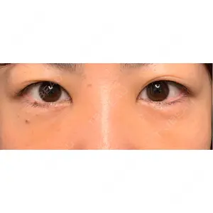 東京シンデレラ美容外科 東京シンデレラ美容外科 池袋院口コミ