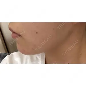 口コミ