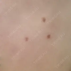 プライベートスキンクリニック 梅田本院口コミ