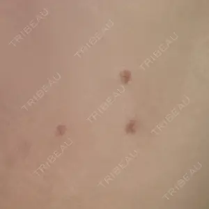 プライベートスキンクリニック 梅田本院口コミ