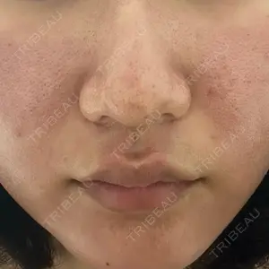ルラ美容クリニック ルラ美容クリニック 札幌院口コミ