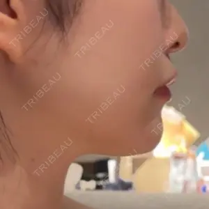 CZEN CLINIC 銀座院口コミ