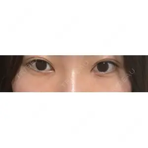 LUHO（ルホ）美容外科口コミ