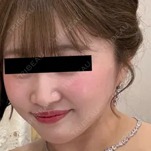 東京シンデレラ美容外科 東京シンデレラ美容外科 池袋院口コミ