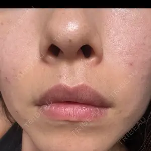 春山記念病院口コミ