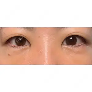 東京シンデレラ美容外科 東京シンデレラ美容外科 池袋院口コミ