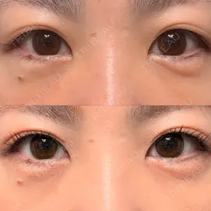 東京シンデレラ美容外科 東京シンデレラ美容外科 池袋院口コミ
