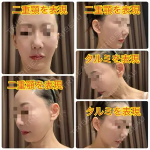 口コミ