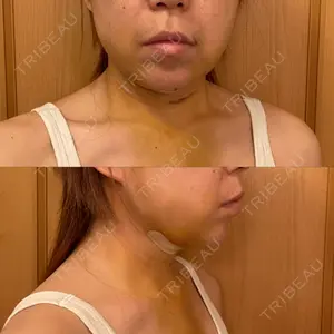 アリエル美容クリニック アリエル美容クリニック 大宮院口コミ
