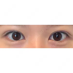 口コミ