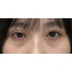 口コミ