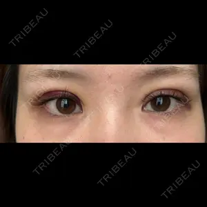 藤・ナチュレ美容クリニック 藤・ナチュレ美容クリニック 銀座院口コミ