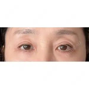 LOCHIC CLINIC GINZA【ロシッククリニック銀座】口コミ