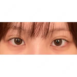 口コミ