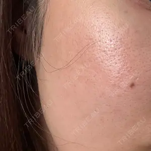 東京シルククリニック 東京シルククリニック 東京神田院口コミ