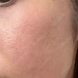 東京シルククリニック 東京シルククリニック 東京神田院口コミ