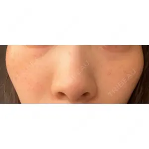 L‘amour clinic Tokyo【ラムールクリニック東京】口コミ