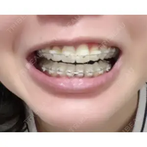 X CLINIC X CLINIC 銀座院口コミ